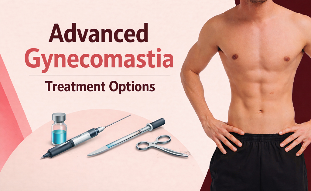 gynecomastia treatment in chennai options